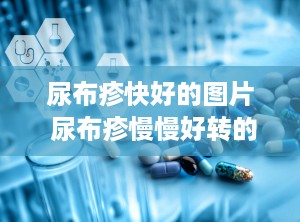 尿布疹快好的图片 尿布疹慢慢好转的表现