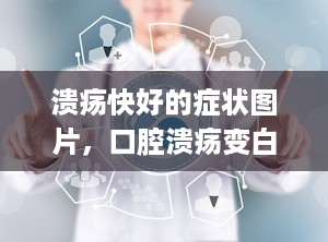 溃疡快好的症状图片，口腔溃疡变白变小变硬是快要好了吗