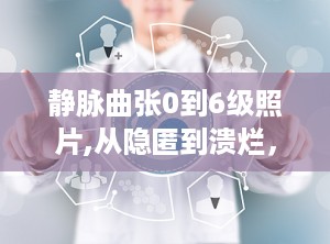 静脉曲张0到6级照片,从隐匿到溃烂，全面了解静脉曲张的演变过程”