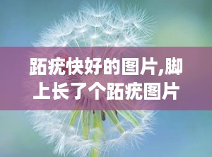 跖疣快好的图片,脚上长了个跖疣图片