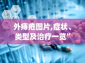 外痔疮图片,症状、类型及治疗一览”