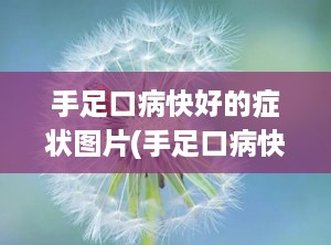 手足口病快好的症状图片(手足口病快好了的症状)
