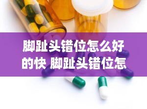 脚趾头错位怎么好的快 脚趾头错位怎么好得快