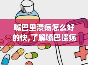 嘴巴里溃疡怎么好的快,了解嘴巴溃疡