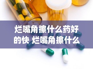 烂嘴角擦什么药好的快 烂嘴角擦什么药好的快一点