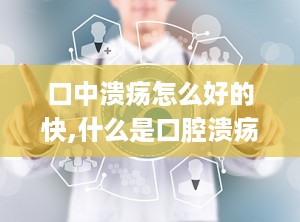 口中溃疡怎么好的快,什么是口腔溃疡