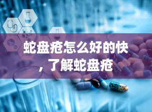 蛇盘疮怎么好的快, 了解蛇盘疮