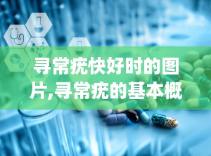 寻常疣快好时的图片,寻常疣的基本概述