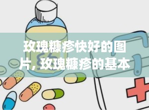 玫瑰糠疹快好的图片, 玫瑰糠疹的基本知识