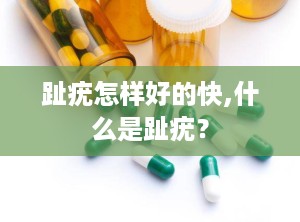 趾疣怎样好的快,什么是趾疣？