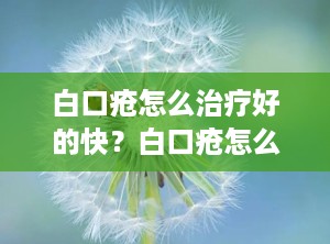 白口疮怎么治疗好的快？白口疮怎么治疗好的快一点