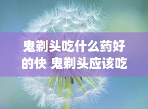 鬼剃头吃什么药好的快 鬼剃头应该吃点什么药