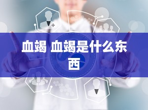 血竭 血竭是什么东西