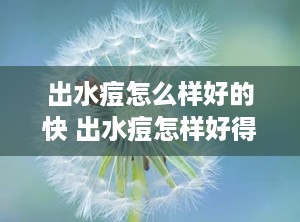 出水痘怎么样好的快 出水痘怎样好得快