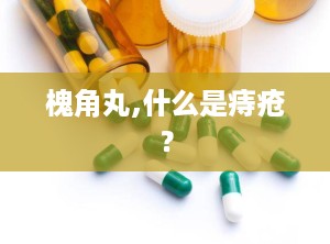 槐角丸,什么是痔疮？
