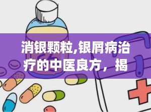 消银颗粒,银屑病治疗的中医良方，揭秘其药理作用与临床应用