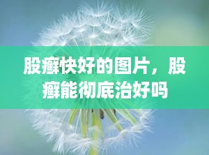 股癣快好的图片，股癣能彻底治好吗