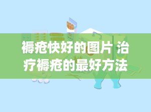 褥疮快好的图片 治疗褥疮的最好方法