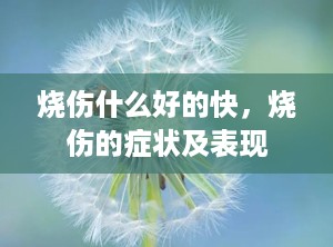 烧伤什么好的快，烧伤的症状及表现